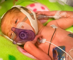 Typical preemie in NICU
